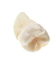 extracted wisdom tooth isoalted on white