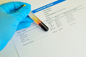 Blood sample with electrolyte testing result