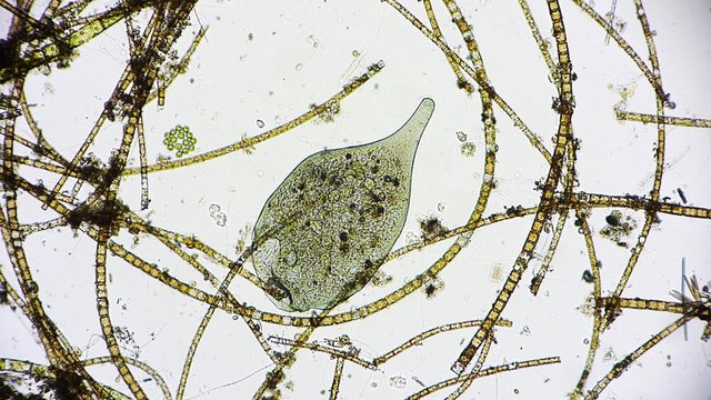 Mikroorganismus unter dem Mikroskop - Mikrokosmos - 1080p Full HD
