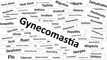 Gynecomastia