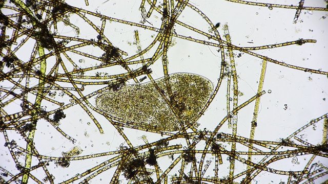 Mikroorganismus unter dem Mikroskop - Mikrokosmos - 1080p Full HD