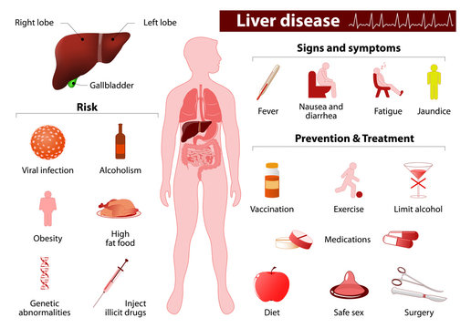 liver disease. Medical infographic
