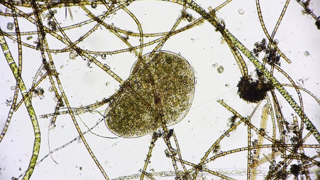 Mikroorganismus unter dem Mikroskop - Mikrokosmos - 1080p Full HD