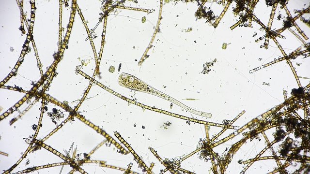 Mikroorganismus unter dem Mikroskop - Mikrokosmos - 1080p Full HD