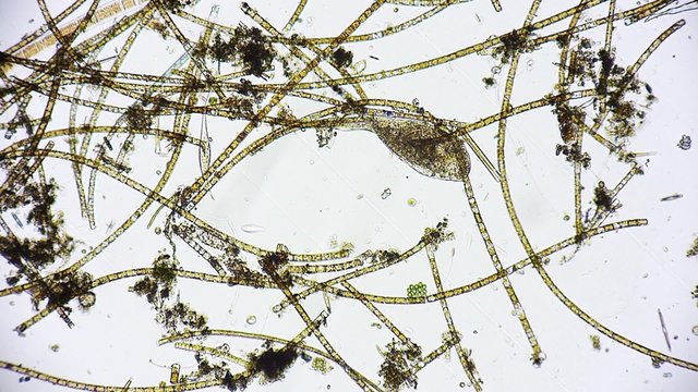 Mikroorganismus unter dem Mikroskop - Mikrokosmos - 1080p Full HD