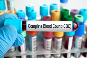 Blood test for Complete Blood Count. CBC