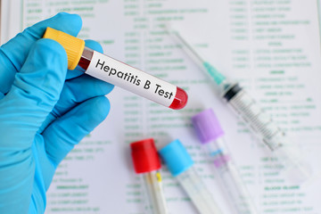 Naklejka premium Blood for hepatitis B virus test