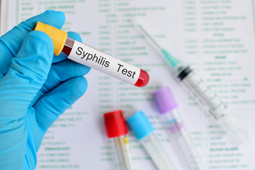 Blood for syphilis test