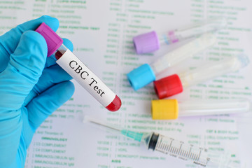 Complete blood count (CBC) test