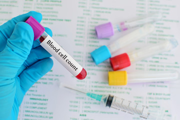 Blood cell count test
