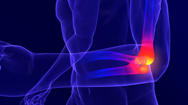 X-ray skeleton animation of elbow pain