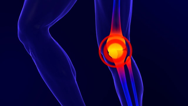 X-ray skeleton animation of knee pain