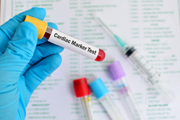 Blood for cardiac marker test