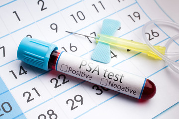Blood test for analysis of PSA / blood sample in a tube with label PSA test on a monthly planner...