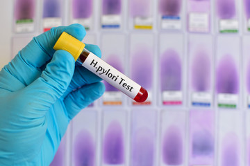 Fototapeta premium Blood for H.pylori test
