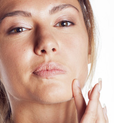 woman with pimple making out close up isolated on white