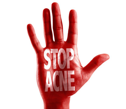 Stop Acne written on hand isolated on white background