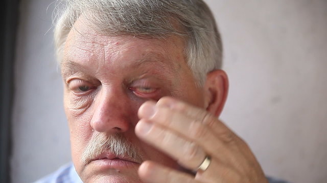 An older man pulls down a lower lid for a better look at his strained eye.