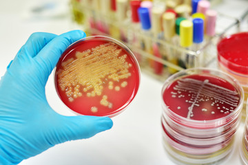 Colony of bacteria in culture medium plate
