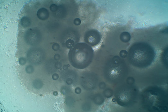 Microscopic view of dried yeast dissolved in water