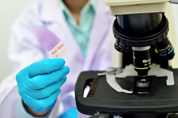 Blood smear for hematology microscopic examination