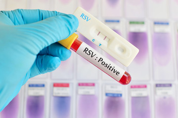 Respiratory syncytial virus (RSV) testing positive