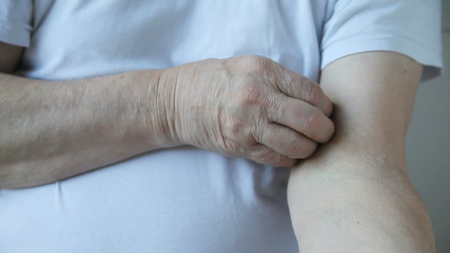 A man scratches his upper arm.