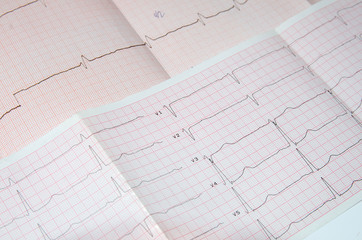 Cardiogram on the grid