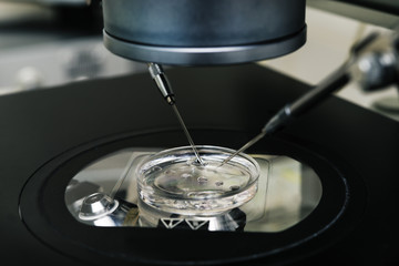 microscope for in vitro fertilization process close up. Equipment on laboratory of Fertilization, IVF. High tech lab equipment.