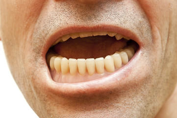 Open mouth with false teeth