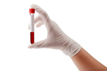 Hand holding test tube with blood plasma ready for testing isola