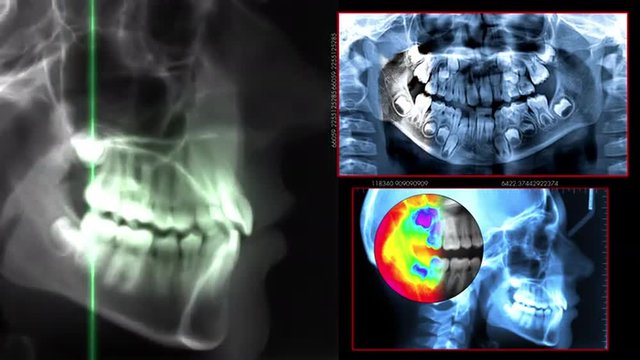 digital dental scan