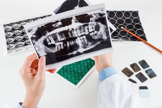 Panoramic dental X-Ray in hand.