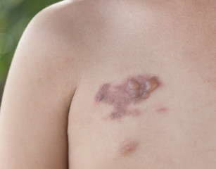 Fototapeta premium skin