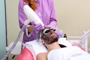 Procedure carbon peeling.