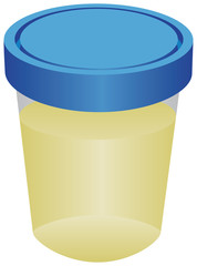 Container with urine for analysis
