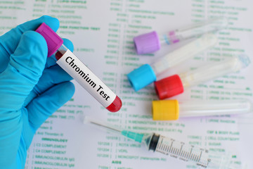 Blood sample for Chromium (Cr) test
