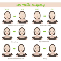 Vector women before and after cosmetic surgery. Cartoon character illustration series