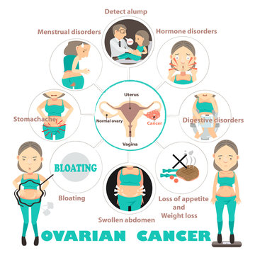 Symptoms of ovarian cancer in circles,info graphic vector illustration