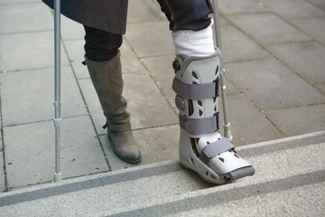 closeup of woman walking with cast on foot