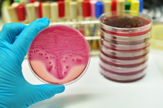 Colony of bacteria in culture medium plate
