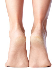 sore skin of feet, dry heels