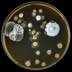 Piastra petri con microrganismi