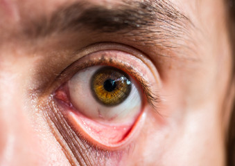 The human eye