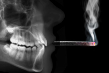 human radiography smoking