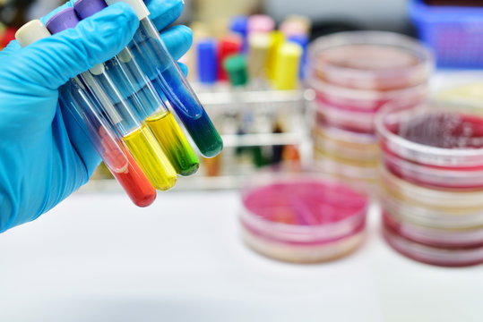 Various of media culture for bacteria identification