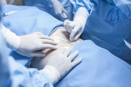 Preparation for a surgery