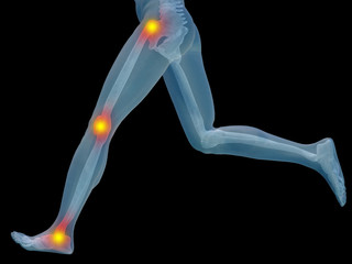 Obraz premium Conceptual human pain anatomy
