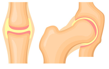 Hip joint structure