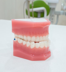 denture

